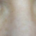 5 weeks 2 days later post opt, swelling has also gone down when I smile and I did drink half a bottle of bacardi silver last night lol so a little hungover, but no hollows..
