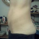 Side view- before