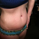 9 weeks post op weight training and cardio.