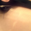 Top view, 2 1/2 hours post op :) Hubby said he can see the cleavage..very happy:)