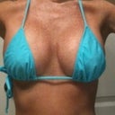 8/21/11 2 1/2 wks post