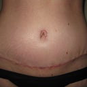 5 weeks