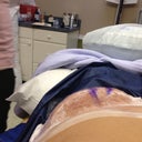 After suction is removed