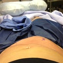 After suction is removed on second side