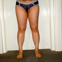 4 weeks post-op
