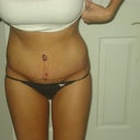 1 week, very swollen