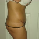 1 week, side view, still can't stand up straight