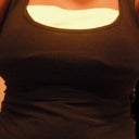 After the surgery, wearing bandadges