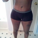 28 days post op 4 weeks still swollen near incision line
