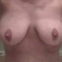 Pre-implant breasts ( after breast feeding 4 babies)