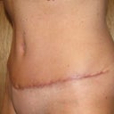 Left view - 4 weeks