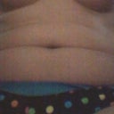 BEFORE SECOND PROCEDURE FRONT