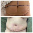 Before and After.