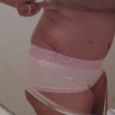Left side still very swollen and body still bruised.