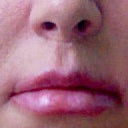 day 11, having doubts :(
in this pic i have makeup on as well,
and i didn't smile at all for comparison