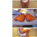 My before pics and skin removed. Not for the faint of heart!