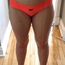 Before - close up
