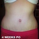 before, 4wks, 8wks
