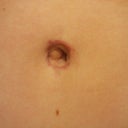 up close BB... that bubble looking thing on the left (my right) my PS said is still swelling. weird.