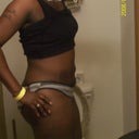 Side View 7 wks post op
