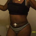 Front View 7 wks post op