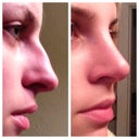 my before and after side by side