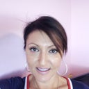 2 weeks after Radiesse/Dysport and I had 1/2 Restalyn injected under eye & fotofacial between the two, love the results.