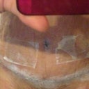 Keep in mind that I am super swollen... And my skin looks wrinkled because of the tank top under my girdle.