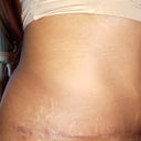 14 weeks PO