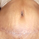 14 weeks front view