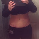 6wks PO just took off my binder the right side scar floats down to match the left by the end of the day so I'm not worried
