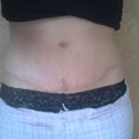 4 weeks, notice it's already looking better in just 1 week?