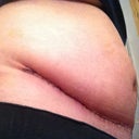 1 wk PO, side