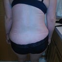 I'm very swollen around my hips for some reason.