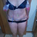 Pubic area is swollen as well.