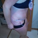 My incision. I'm happy with it's position.