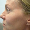 Profile with good view of lines around eyes
