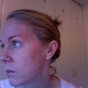 Profile showing smoother, tighter skin around eyes