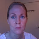 Two months later, photo with no makeup
