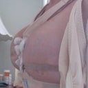 Dr.Turkeltaubs work, they are awesome and beautiful he really knows his work and im very pleased.... I have other pictures but they wont download on here yet..