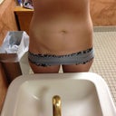 Extra skin, fat and stretch marks. Ick!