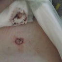 The new belly button.