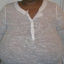 6 days before surgery... Dr. Schreiber estimated that I was a J cup. After seeing the pictures I took, I totally believe it!