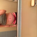 Drains came out today! 6 days post op