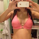 1 week post op. left all ready dropping!