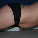 preop plank