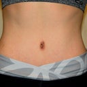 6 months, taken the day after steroid shots