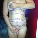 After my consult