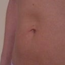 8 weeks post