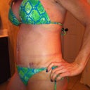 Other side, again feel thick and swollen